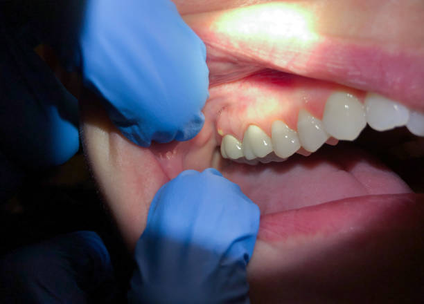 Best Emergency Root Canal Treatment in Mianna, AR